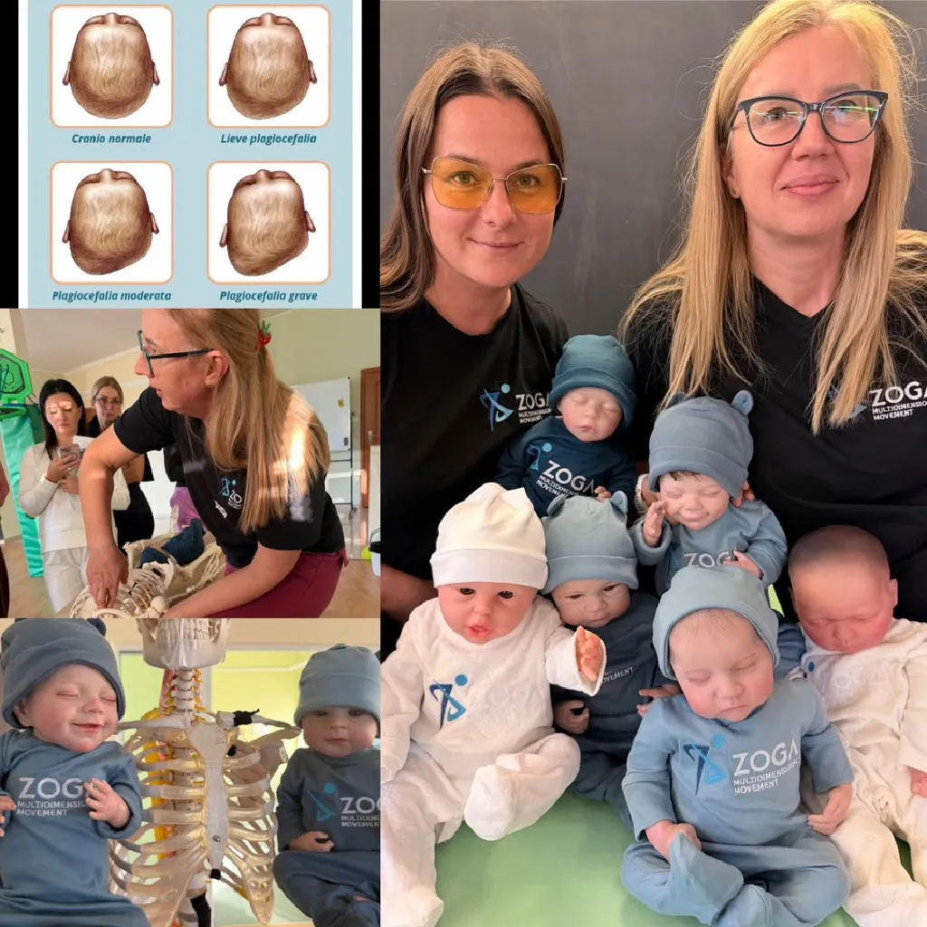 Zoga Therapy Study Group